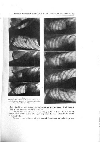 Lotta contro la tubercolosi rivista mensile