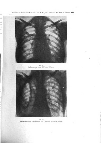 Lotta contro la tubercolosi rivista mensile