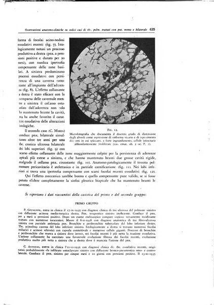 Lotta contro la tubercolosi rivista mensile