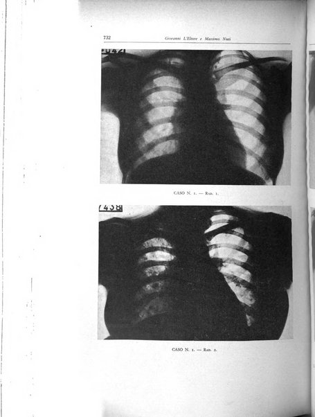 Lotta contro la tubercolosi rivista mensile