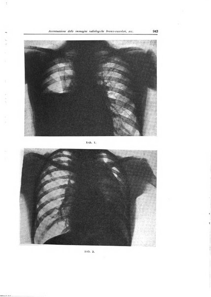 Lotta contro la tubercolosi rivista mensile