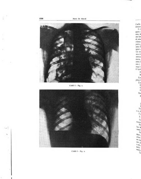 Lotta contro la tubercolosi rivista mensile