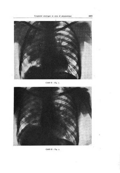 Lotta contro la tubercolosi rivista mensile