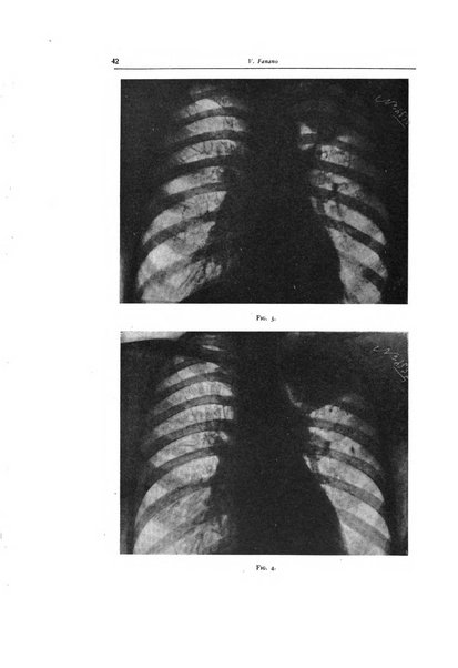 Lotta contro la tubercolosi rivista mensile