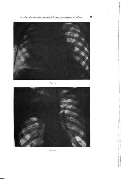 Lotta contro la tubercolosi rivista mensile