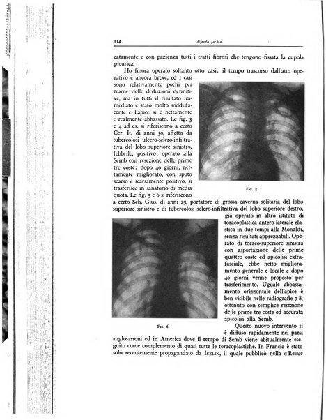 Lotta contro la tubercolosi rivista mensile