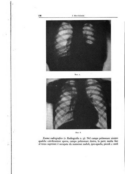 Lotta contro la tubercolosi rivista mensile