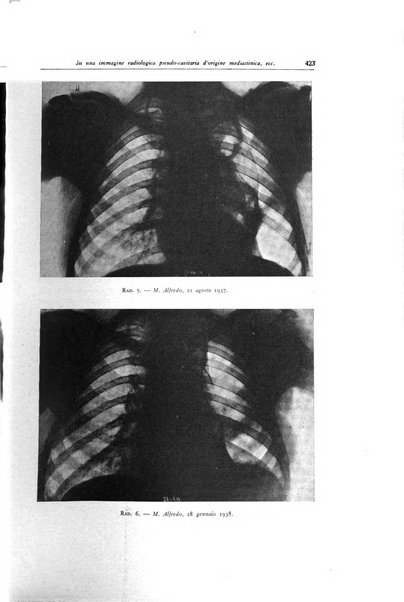 Lotta contro la tubercolosi rivista mensile