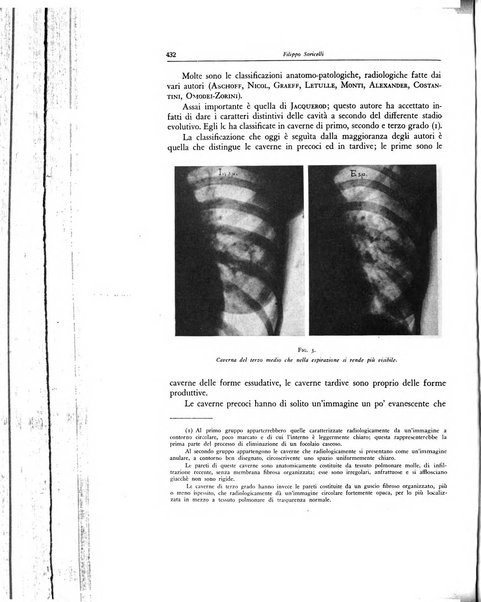 Lotta contro la tubercolosi rivista mensile