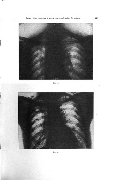 Lotta contro la tubercolosi rivista mensile