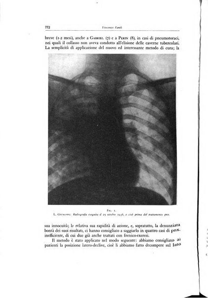 Lotta contro la tubercolosi rivista mensile