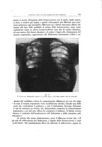 Lotta contro la tubercolosi rivista mensile