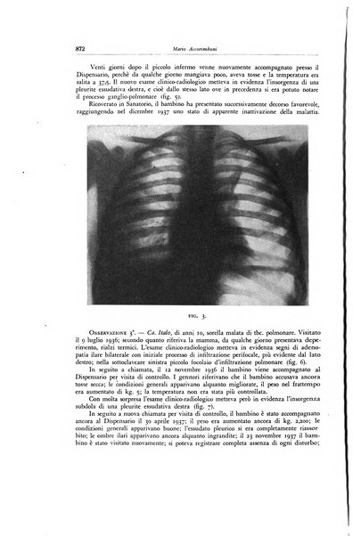 Lotta contro la tubercolosi rivista mensile