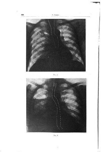 Lotta contro la tubercolosi rivista mensile