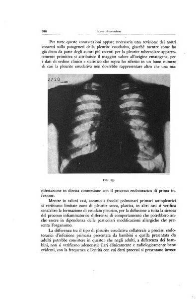 Lotta contro la tubercolosi rivista mensile