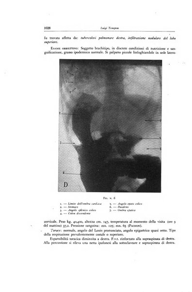 Lotta contro la tubercolosi rivista mensile