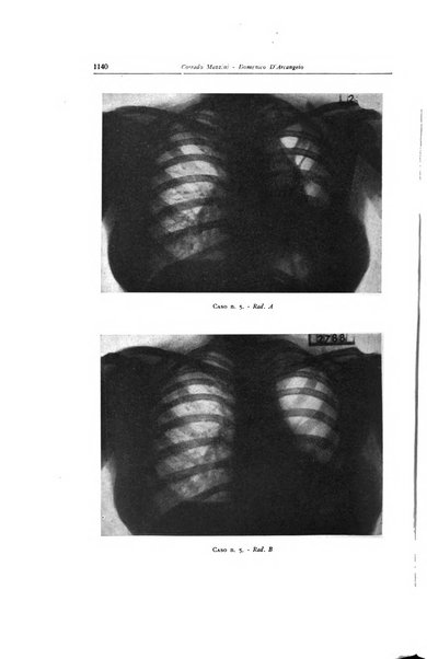 Lotta contro la tubercolosi rivista mensile