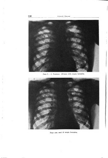 Lotta contro la tubercolosi rivista mensile