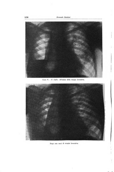 Lotta contro la tubercolosi rivista mensile