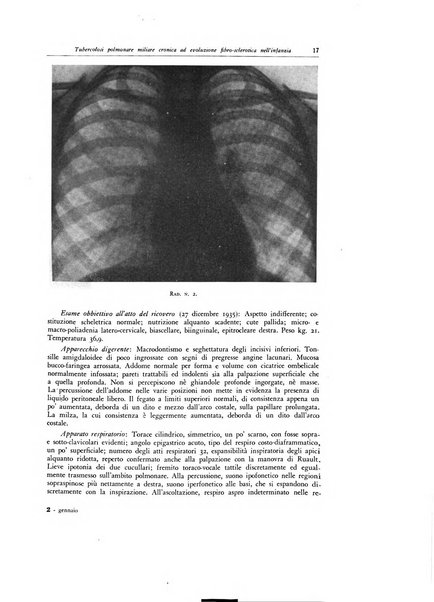 Lotta contro la tubercolosi rivista mensile