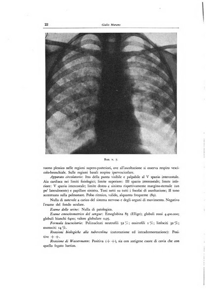 Lotta contro la tubercolosi rivista mensile