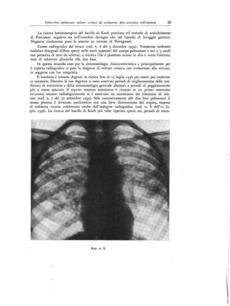 Lotta contro la tubercolosi rivista mensile