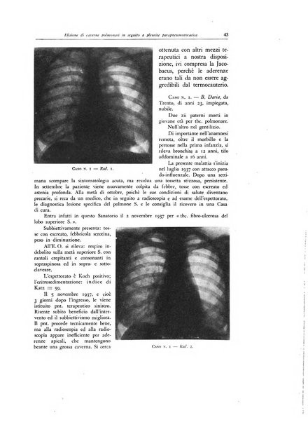 Lotta contro la tubercolosi rivista mensile