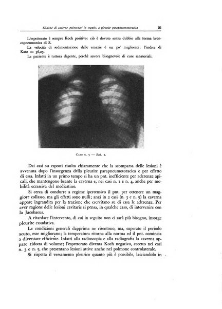 Lotta contro la tubercolosi rivista mensile