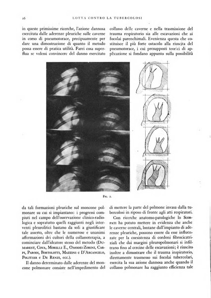 Lotta contro la tubercolosi rivista mensile