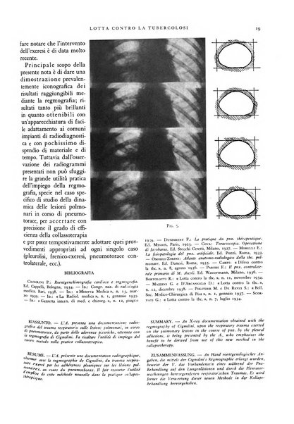 Lotta contro la tubercolosi rivista mensile