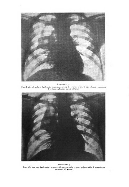 Lotta contro la tubercolosi rivista mensile