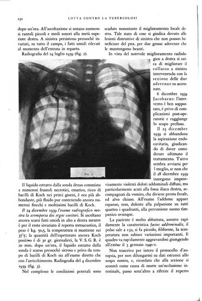 Lotta contro la tubercolosi rivista mensile