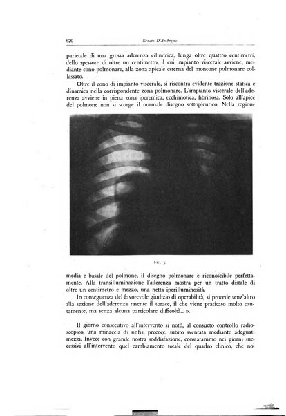 Lotta contro la tubercolosi rivista mensile