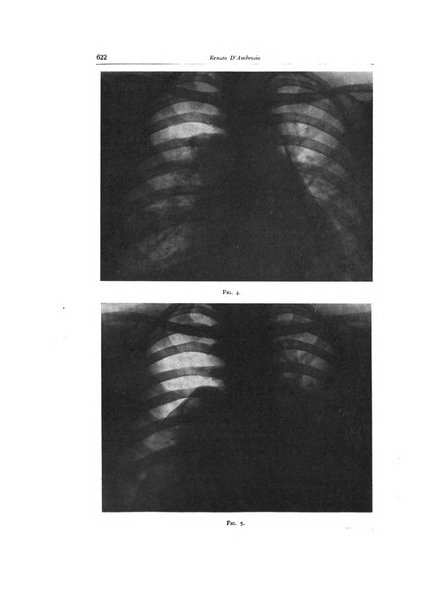 Lotta contro la tubercolosi rivista mensile