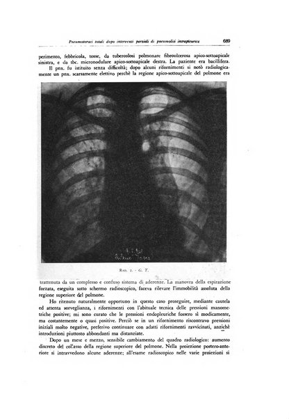 Lotta contro la tubercolosi rivista mensile