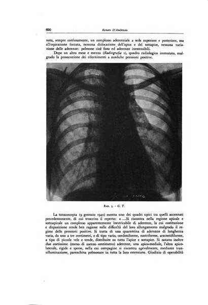 Lotta contro la tubercolosi rivista mensile