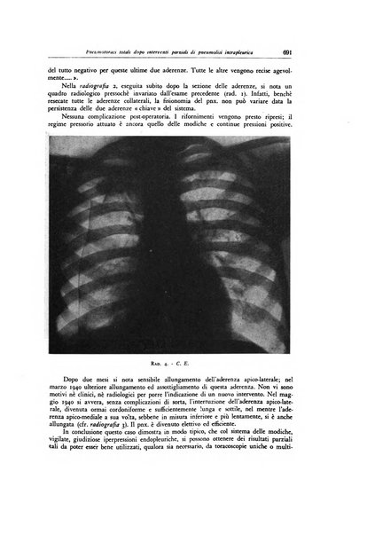 Lotta contro la tubercolosi rivista mensile