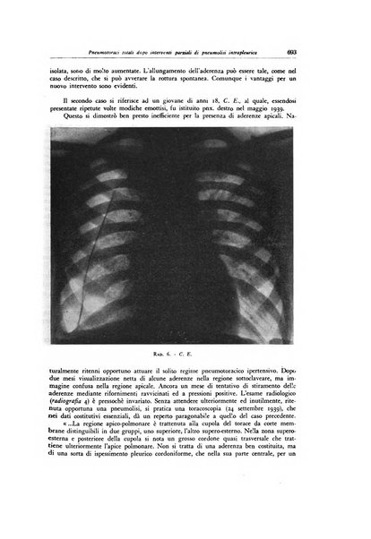 Lotta contro la tubercolosi rivista mensile