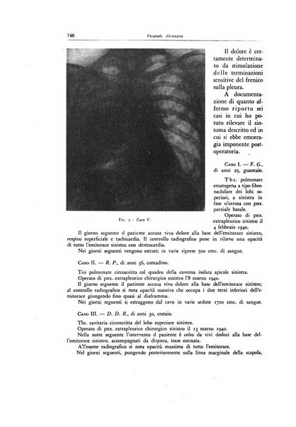 Lotta contro la tubercolosi rivista mensile