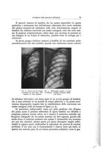 Lotta contro la tubercolosi rivista mensile