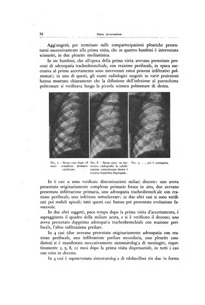 Lotta contro la tubercolosi rivista mensile