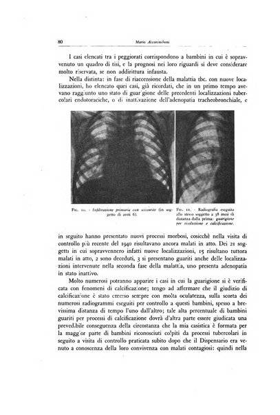 Lotta contro la tubercolosi rivista mensile