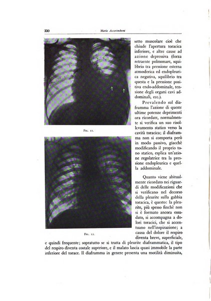 Lotta contro la tubercolosi rivista mensile