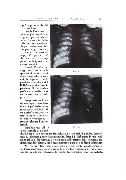 Lotta contro la tubercolosi rivista mensile