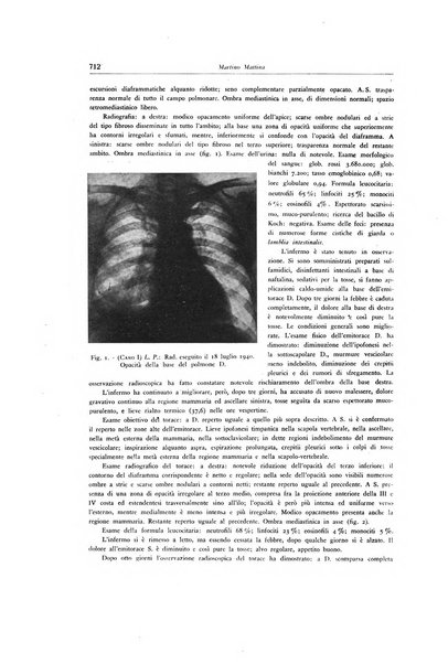 Lotta contro la tubercolosi rivista mensile