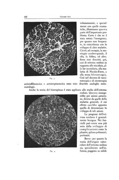 Lotta contro la tubercolosi rivista mensile