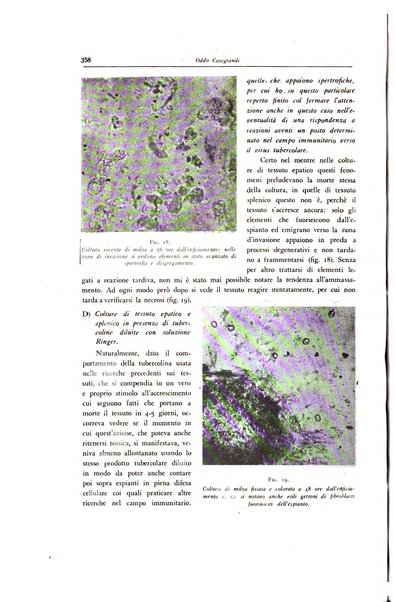 Lotta contro la tubercolosi rivista mensile