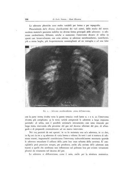 Lotta contro la tubercolosi rivista mensile