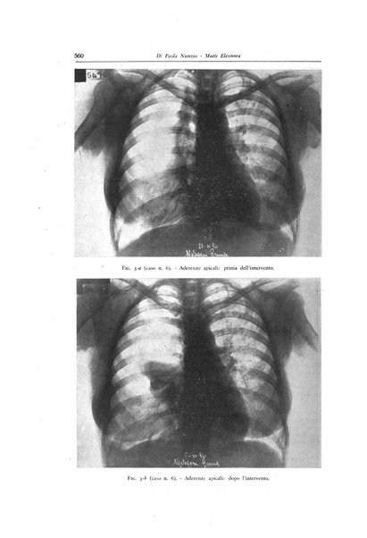 Lotta contro la tubercolosi rivista mensile