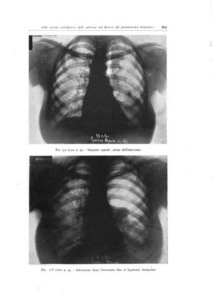 Lotta contro la tubercolosi rivista mensile